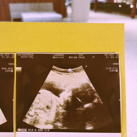 เมื่อแม่อยากอยากรู้เพศลูกมาก