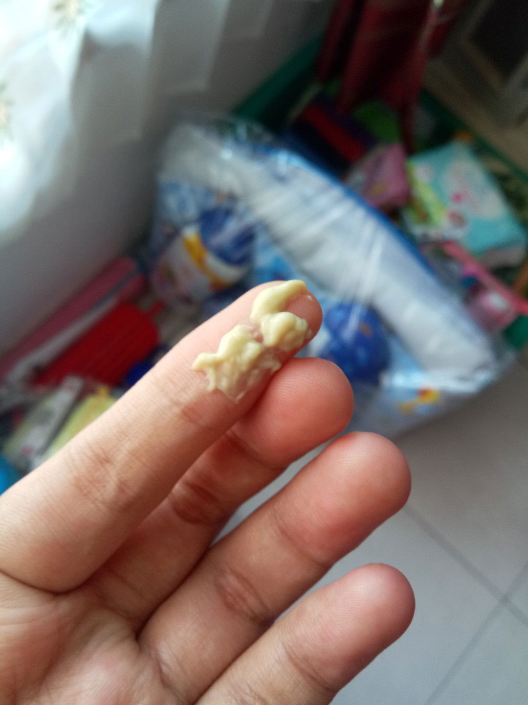 36w keputihan menggumpal