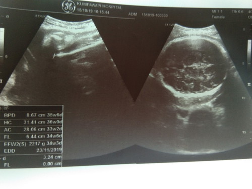33w 2217gแล้ว ?