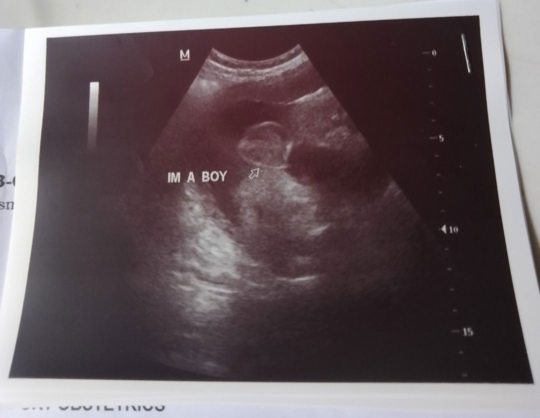 Baby boy o baby girl ba tlaga?