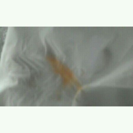 warna ingus
