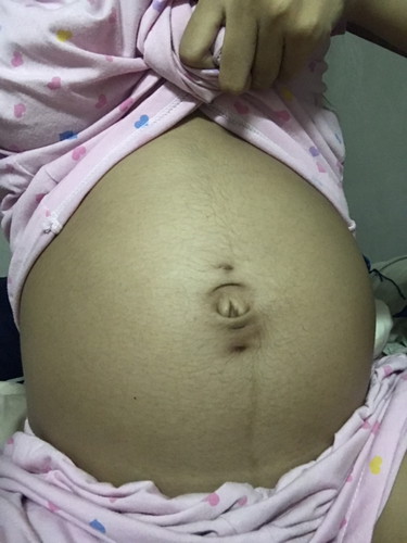 ท้องแบบนี้ผู้ชายหรือผู้หญิงคะแม่