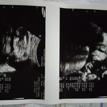 ขอพื้นที่แชร์ประสบการณ์หน่อยค่า