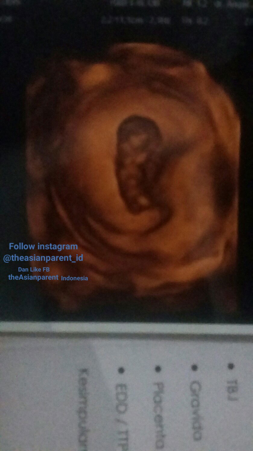 Saat Hamil Buah Hati