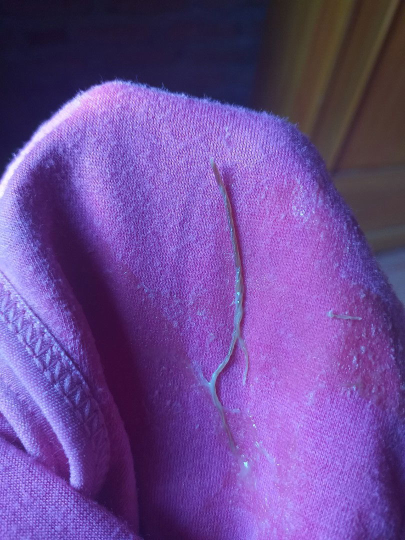 Keluar Benang Dari miss v