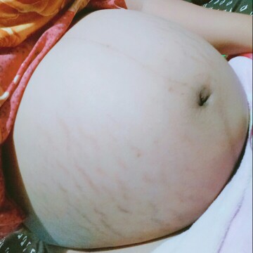 ตั้งครรภ์