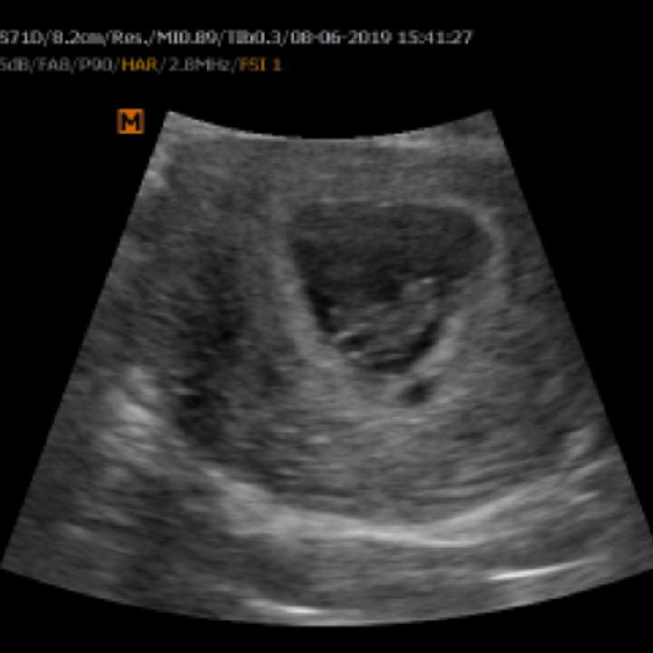 พยายามอยู่เฉยๆเพื่อหนูเลย