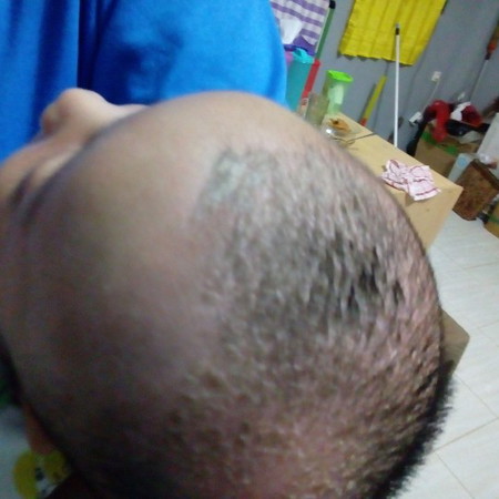 kulit kepala bayi