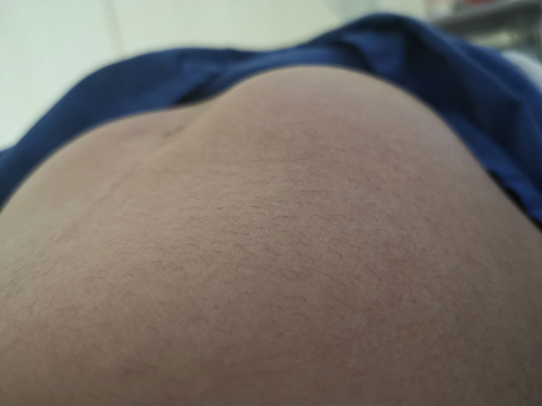 ท้องแข็ง อย่าชะล่าใจ!!!