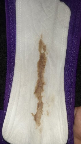 Hello mga miii. Tanong q lg po