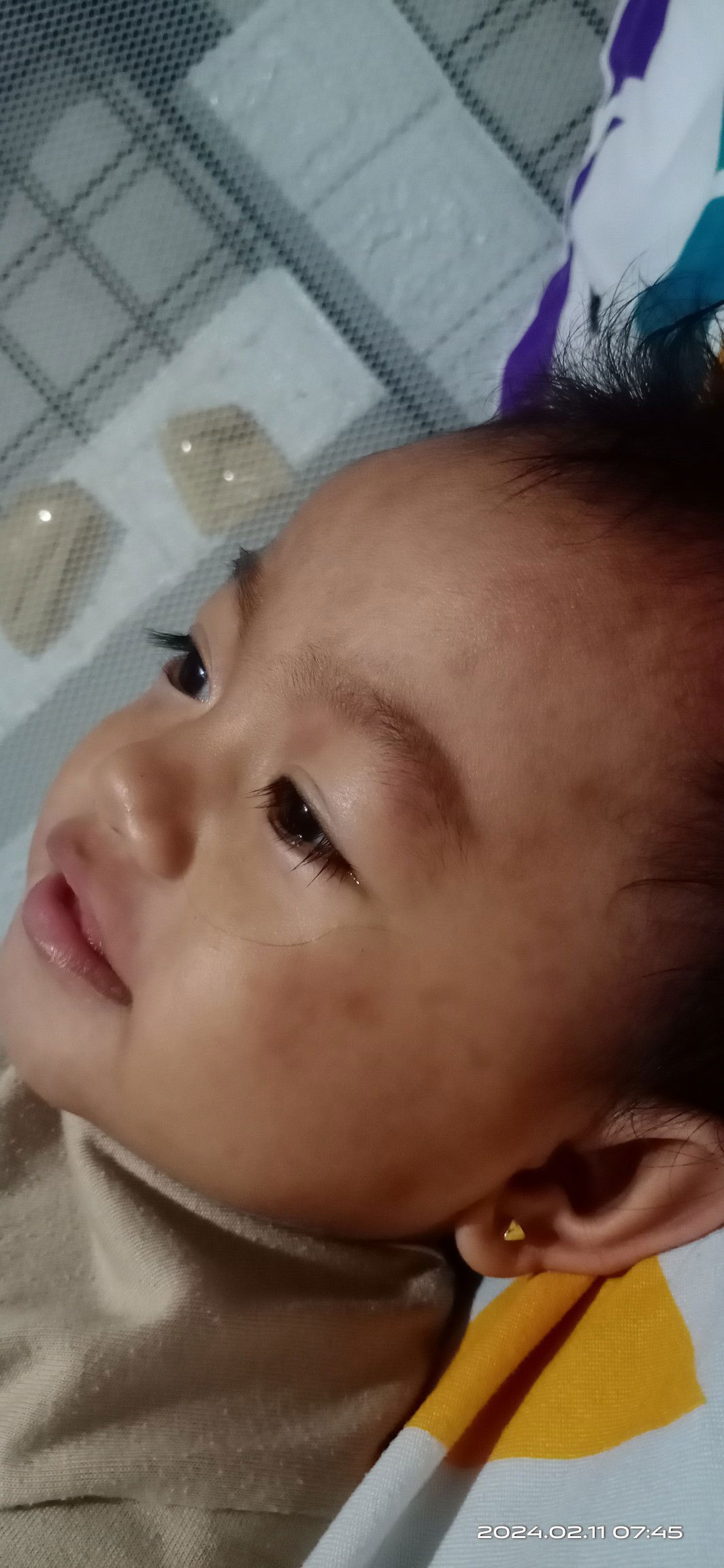 Hello ka mommy ask kulang kung tigdas hangin poba ang tawag sa red po na yan sa face ni baby?