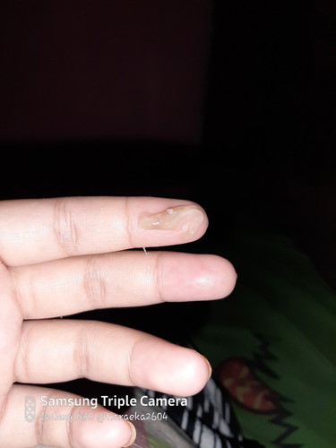 kenapa ya bun keluar gumpalan seperti ini ?