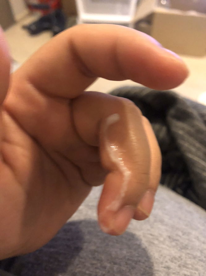 ใช่มูกหรือเปล่าคะ