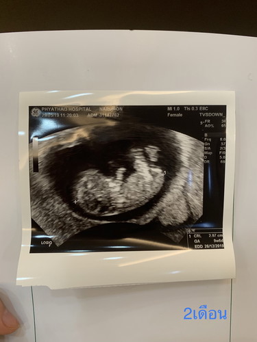 เธอคือของขวัญ