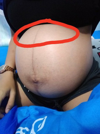อาการแบบนี้คือไรค่ะแม่ๆ
