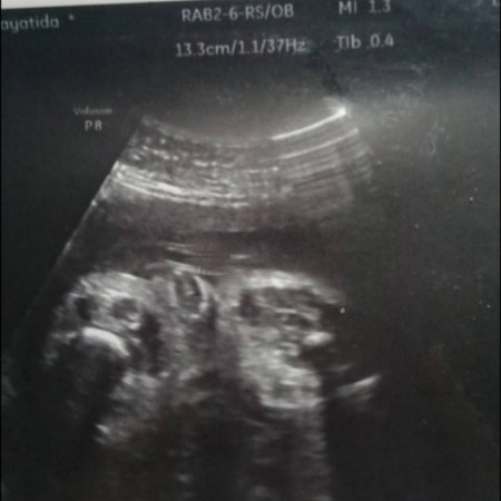 31week2d แล้วจ้า