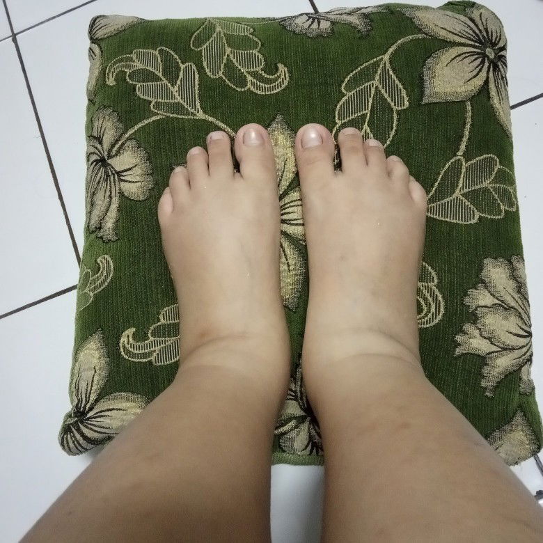 KAKI BENGKAK ABIS MELAHIRKAN