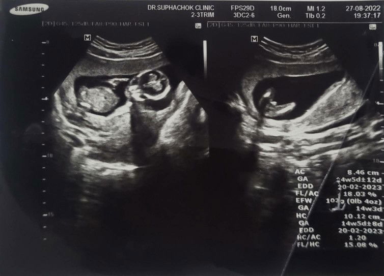 Tpoart Ptaotr profile icon