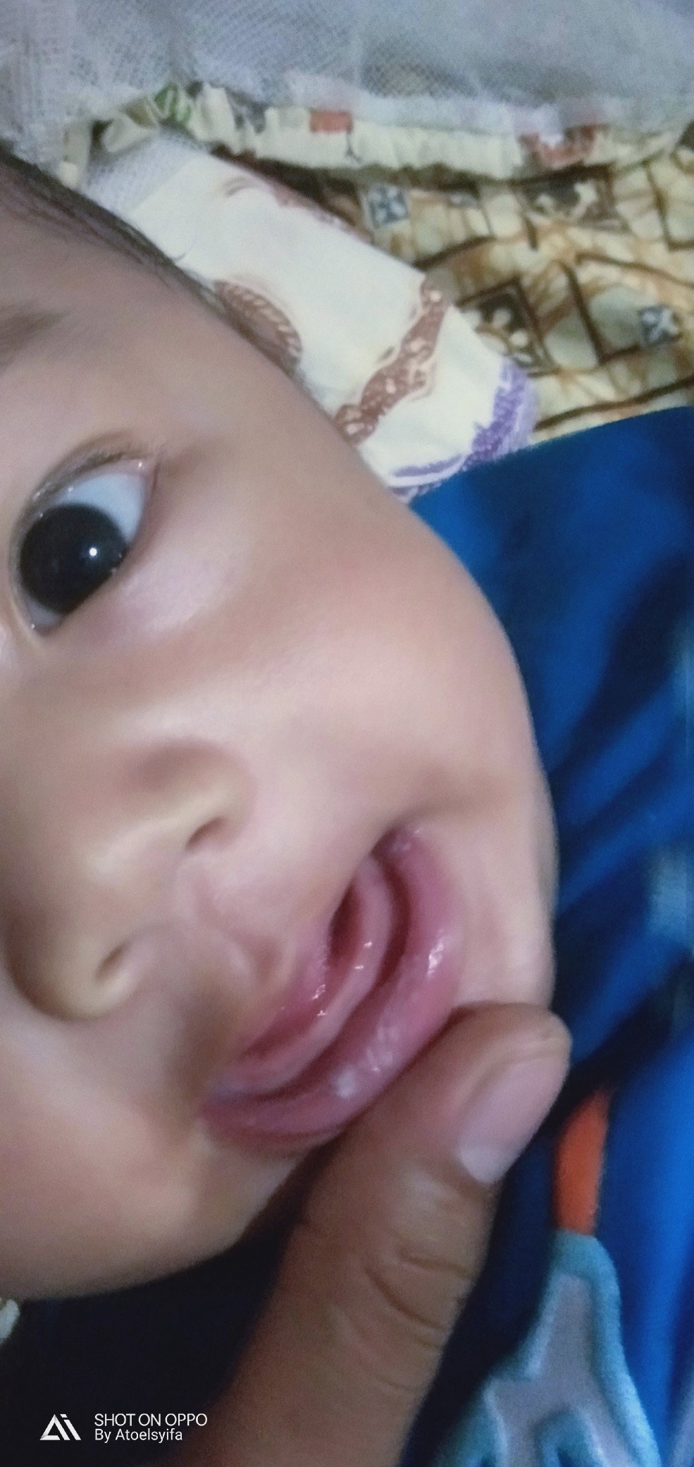 Putih2 dbibir bayi