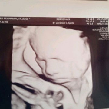 nurmayani profile icon