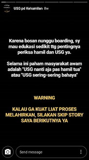 USG