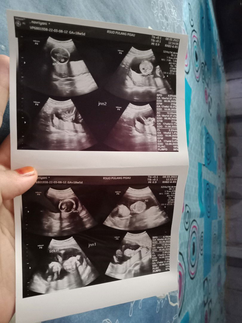 Novriyani profile icon