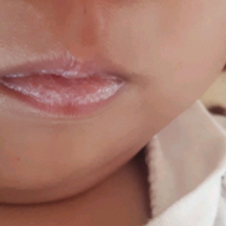 bibir putih