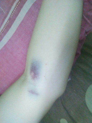 ไปเจาะเลือดมา