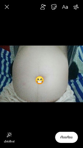 21วีค ท้องอืดมาก