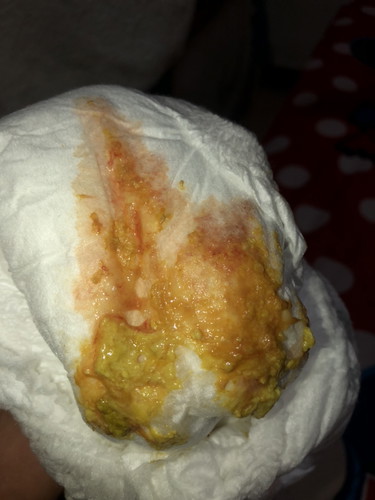 ลูกชาย6เดือนอึเป็นสีนี้ค่ะ