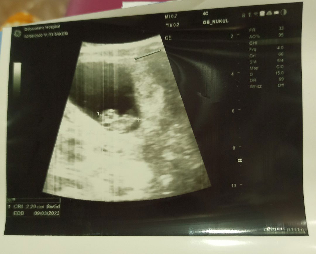 Ben Benjawan profile icon