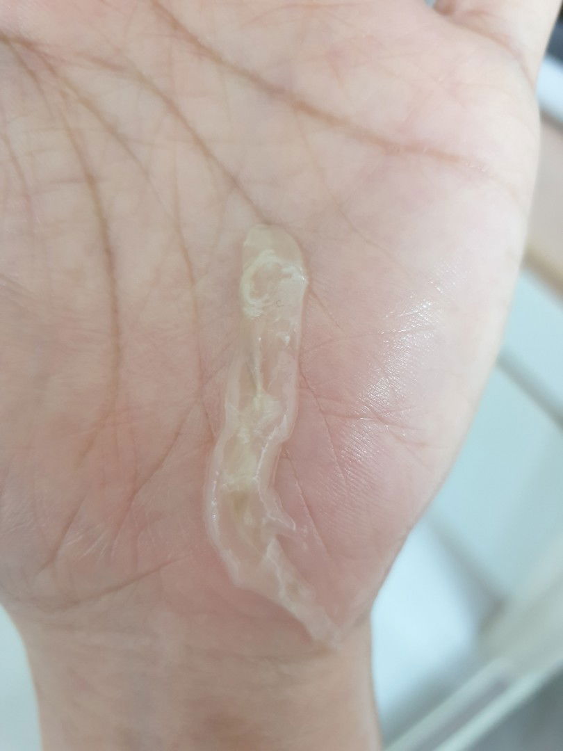 ถามหน่ยค่ะ ตั้งครรภ์ 7สัปดาห์กว่า มีมูกออกมาแบบนี้ปกติไหมคะ