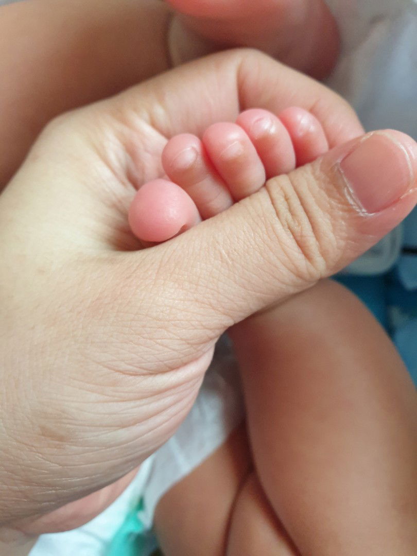 ปัญหาเล็บเท้าลูก