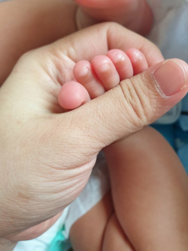 ปัญหาเล็บเท้าลูก