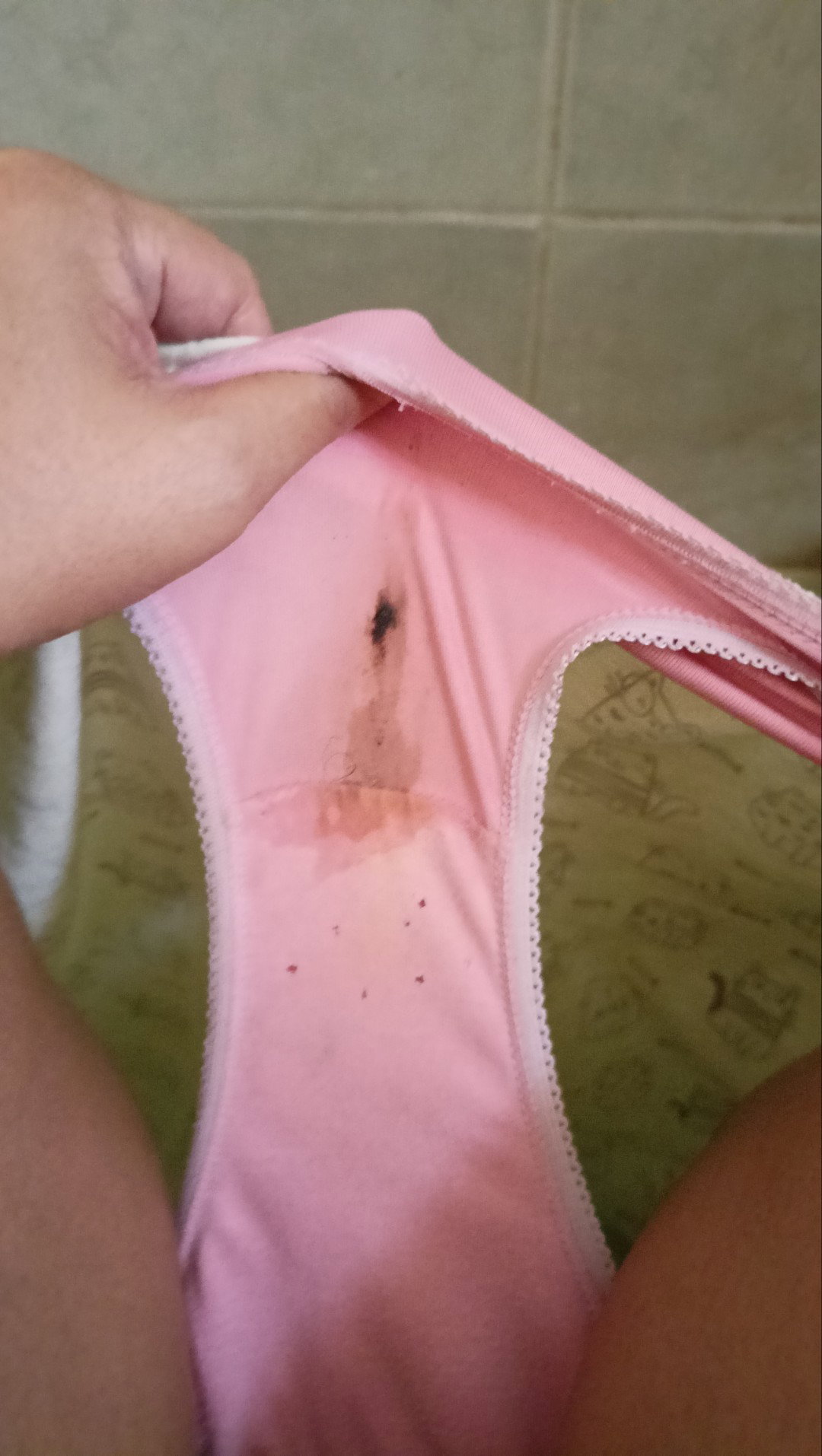 Normal po ba yung kaunting blood sa undies 26 weeks na po ako ngayun?