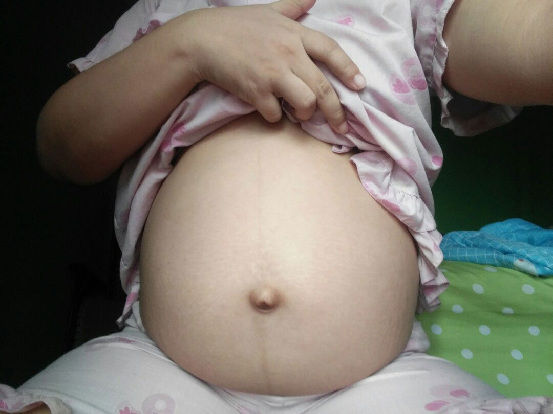 ถามคุณแม่ท้องแฝด