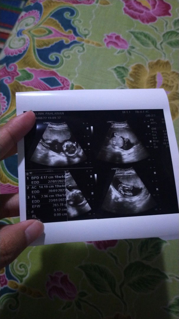 Sefti Fira Pratiwi profile icon