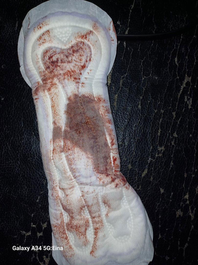 Keluar darah pregnant 15week