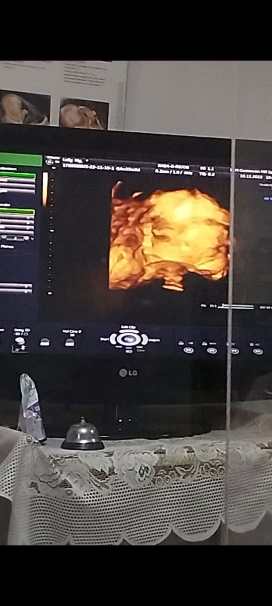 Luly Tri Maulidia Adzani profile icon