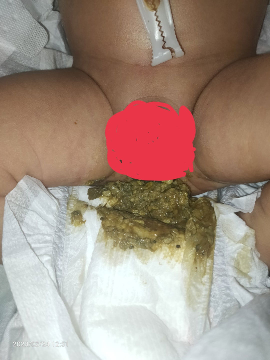 Normal lang ba new born ang pumupu Ng parang may buto ng okra Basta tignan nyo nalang po