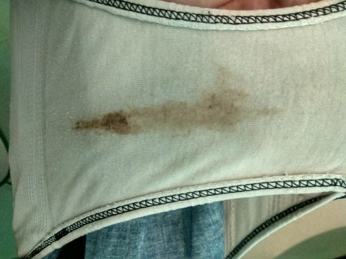 Brown discharge