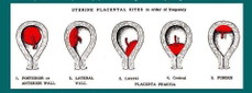 Types of Placenta