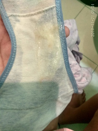 Mucus Plug na ba ito?