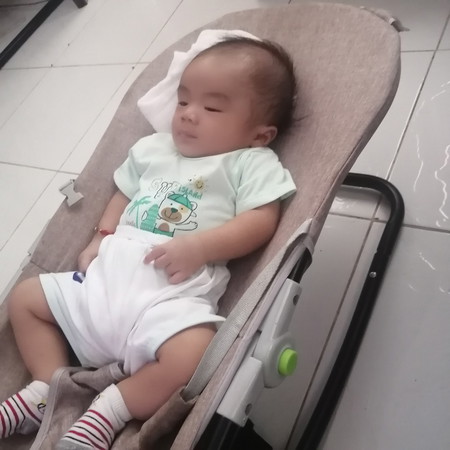 helo po ask ko lang po Sabi daw po kasi sa center nung nag pa bakuna kme my hydrocepalus daw po baby