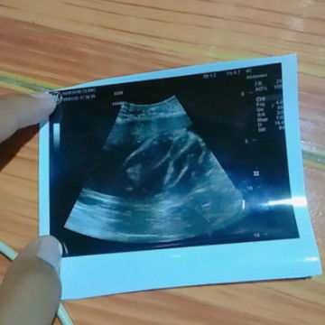 เเบบนี้ผู้หญิงหรือผู้ชายค่ะเเม่พอดีว่าดูไม่เป็นค่ะ😂