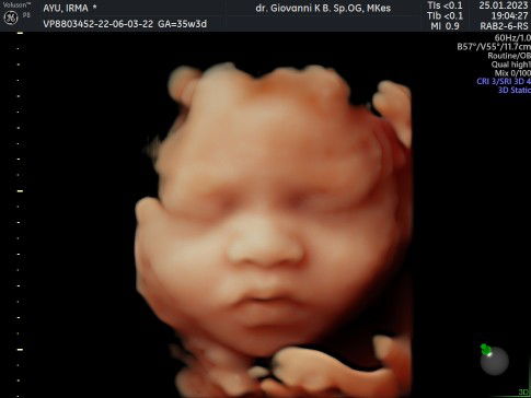 Irma ayu Puspitasari profile icon