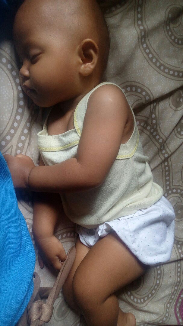 anak demam karna tumbuh gigi geraham