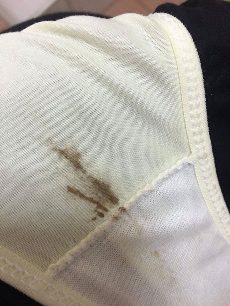 ตกขาวสีน้ำตาลตอน38วีค3วันแต่ไม่ปวดท้อง