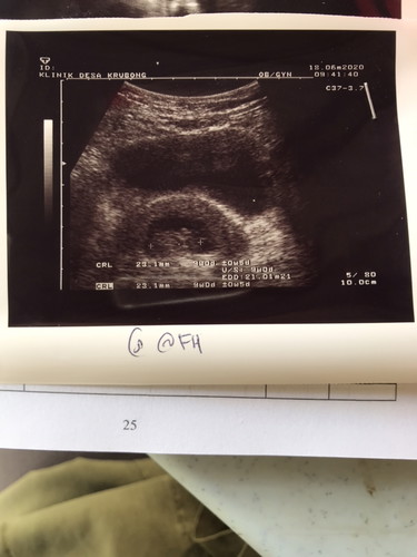 First time tengok baby 9 weeks & dah ada heartbeat