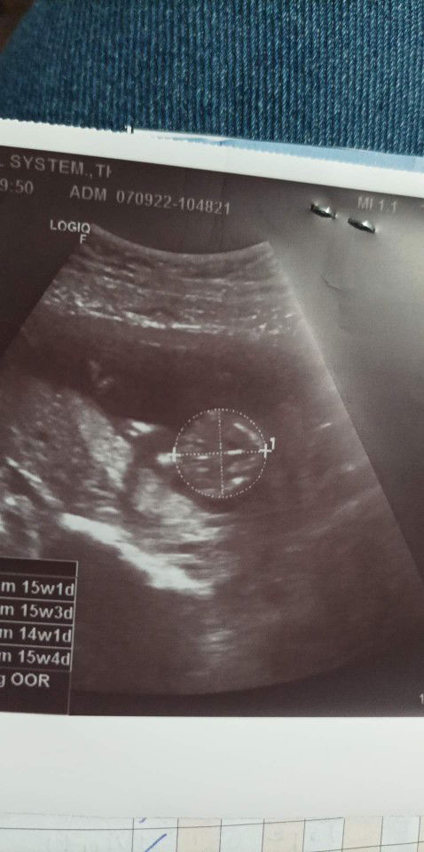 น้ำ มันดื้อ profile icon